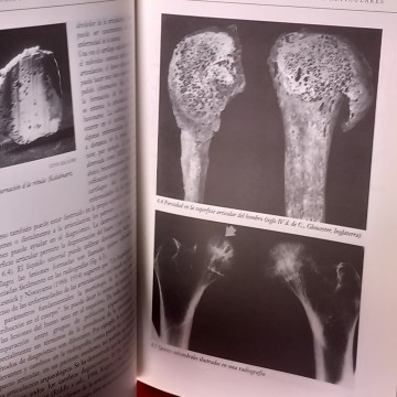 ARQUEOLOGÍA DE LA ENFERMEDAD, CHARLOTTE ROBERTS