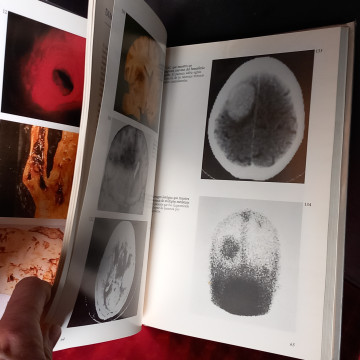 ICTUS, ATLAS DE ENFERMEDAD VASCULAR CEREBRAL Y SU TRATAMIENTO, ASIF KAMAL.