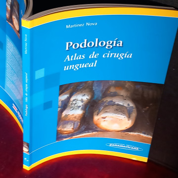 PODOLOGÍA, ATLAS DE CIRUGÍA UNGUEAL, MARTÍNEZ NOVA.