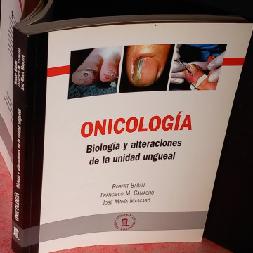ONICOLOGÍA, BIOLOGÍA Y ALTERACIONES DE LA UNIDAD UNGUEAL, ROBERT BARAN.