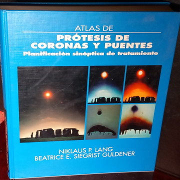ATLAS DE PRÓTESIS DE CORONAS Y PUENTES.