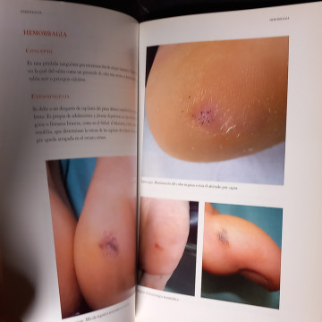 MANUAL Y ATLAS DE LAS ENFERMEDADES CUTÁNEAS DEL PIE