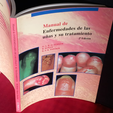 MANUAL DE ENFERMEDADES DE LAS UÑAS Y SU TRATAMIENTO.