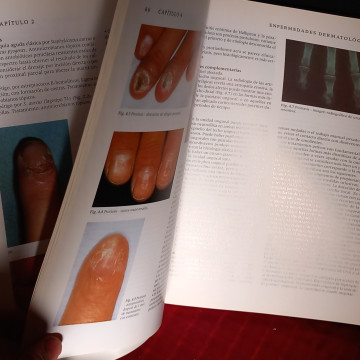 MANUAL DE ENFERMEDADES DE LAS UÑAS Y SU TRATAMIENTO.
