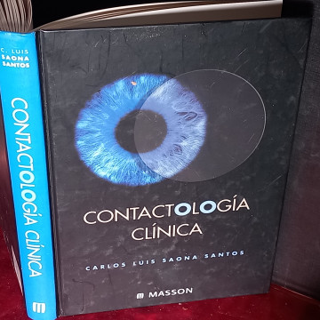 CONTACTOLOGÍA CLÍNICA, CARLOS LUIS SAONA SANTOS.