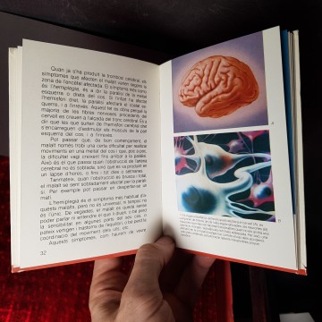 Accidents vasculars cerebrals la feridura llibre de medicina