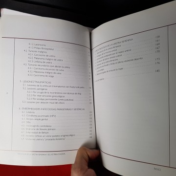 Patología de la uretra femenina y del vestíbulo vaginal Octavio Arango