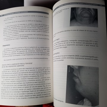 Otorrinolaringología y patología cervicofacial, Ignacio Cobeta