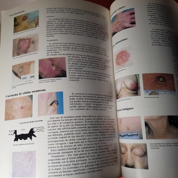 ABC de la dermatología, PK buxton, áncora s a